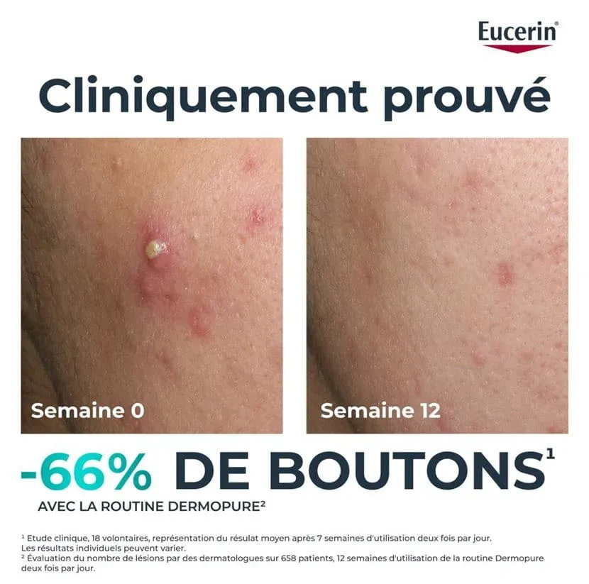 EUCERIN DERMOPURE CLINICAL FLUIDE TRIPLE CORRECTION 40ML-5.webp