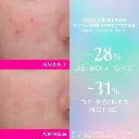 NUXE ZINC POWER SERUM ANTI-IMPERFECTIONS 30ML-3.webp